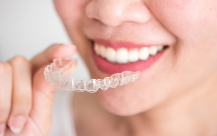 Элайнеры – это прозрачные съемные капы, изготовленные на основе данных 3D-сканирования зубов пациента.